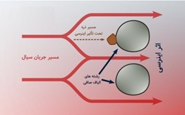اثر اینرسی در فیلتراسیون